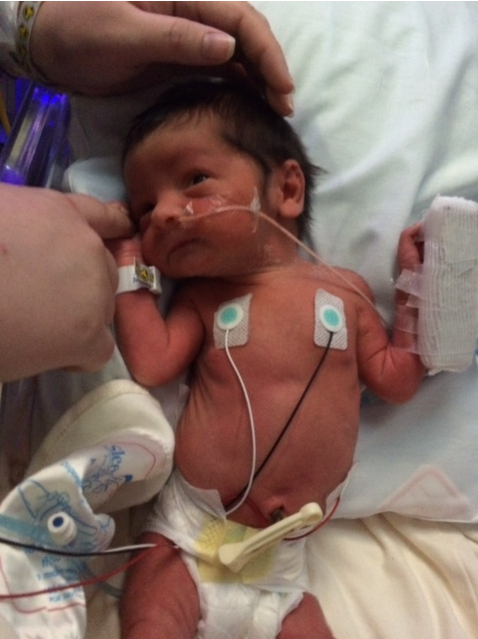 Baby in NICU
